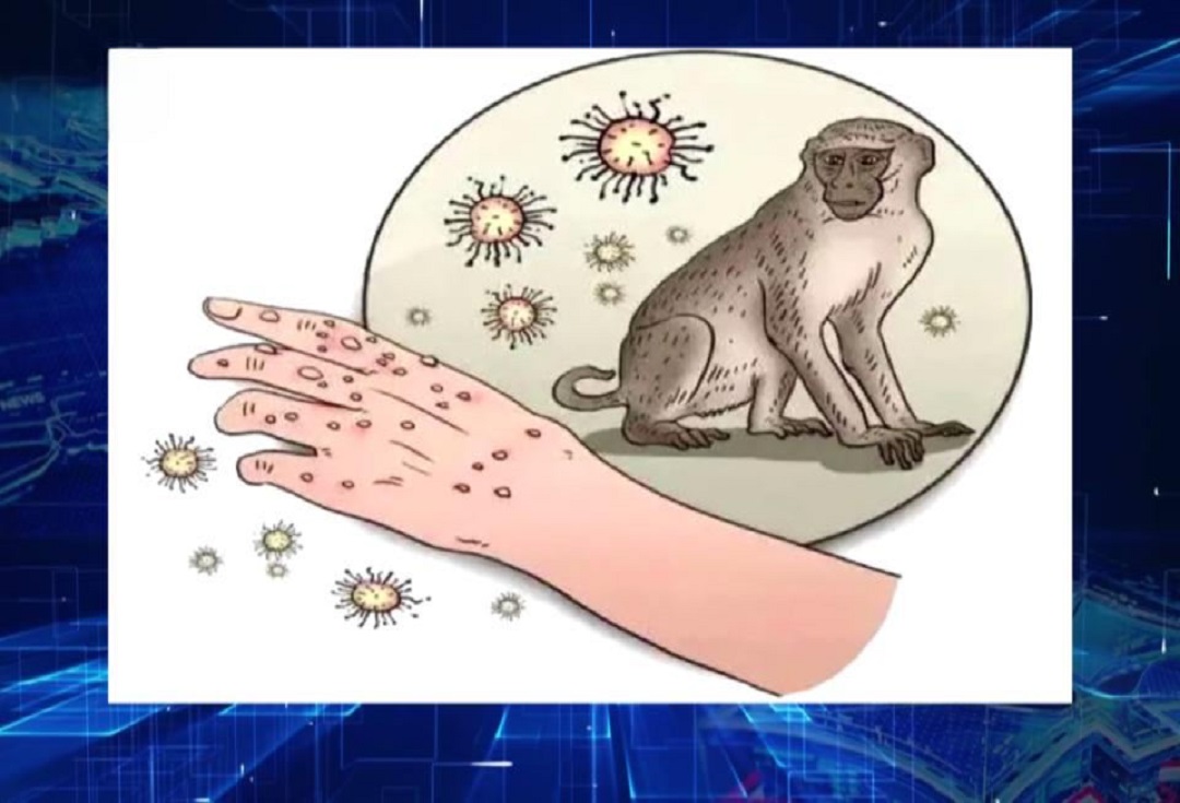 Apa Sampeyan Perlu Ngerti babagan Virus Monkeypox?