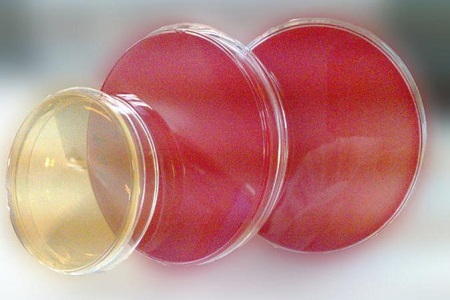 Salmonella Shigella Agar (SS): Medium Penting Kanggo Pengasingan Patohogen