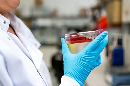 Kit Pengangkutan Virus (ora aktif) - Koleksi Sample Viral Aman