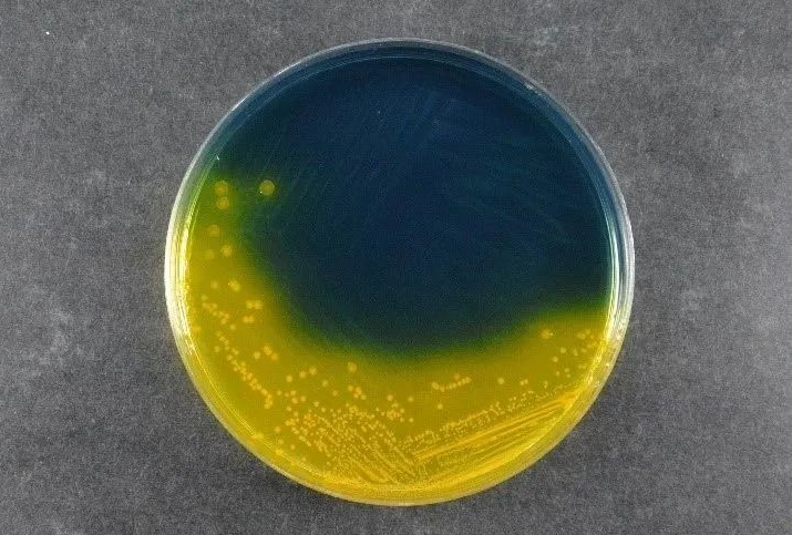 Njamin keamanan panganan: Salmonella Shigella Shigella Agar (SS) ndhukung standar deteksi patogen global