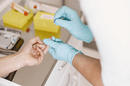 Kit tes rapidalan (emas kolam): solusi deteksi sing cepet lan dipercaya