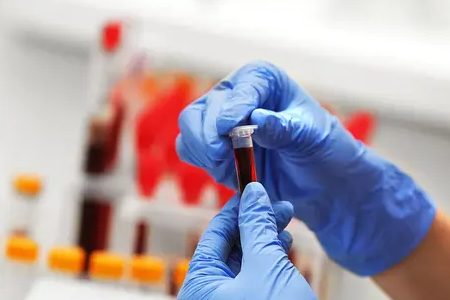 Deteksi Rapid Malauria: Kit Antigen Dual Babi's Kargo Kesehatan Global