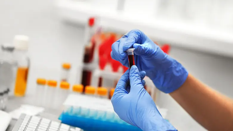 BABIO Ngenalake Kit Tes Rapid Antigen H. pylori sing bisa dipercaya kanggo Skrining Gastrointestinal Cepet