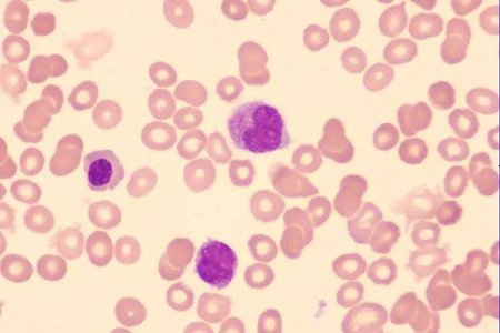 Medium Vaksin Paratyphoid Babi kanggo Produksi Vaksin Veteriner